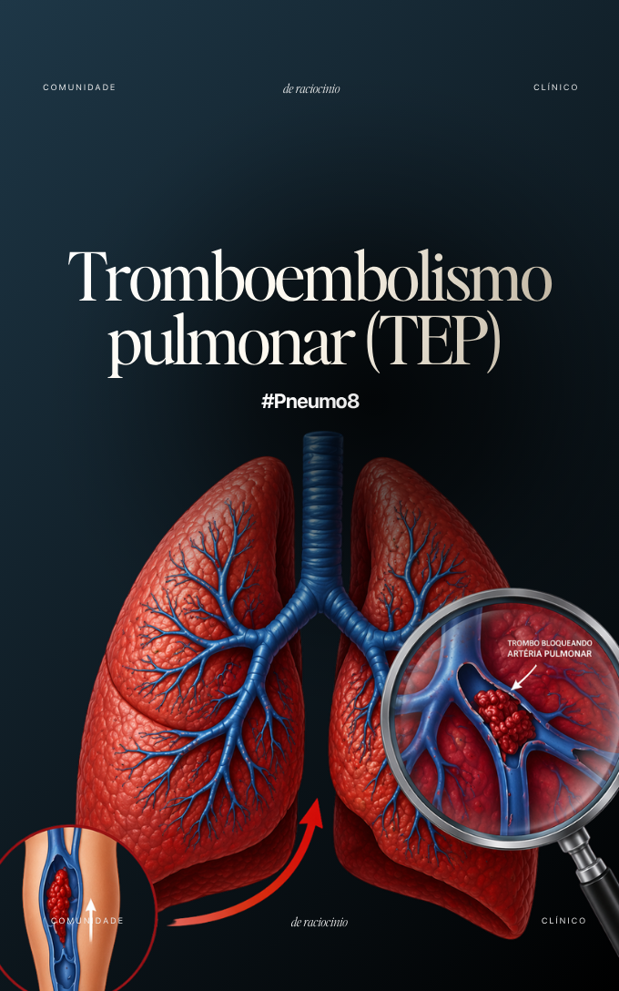 Capa de módulo da Comunidade RC