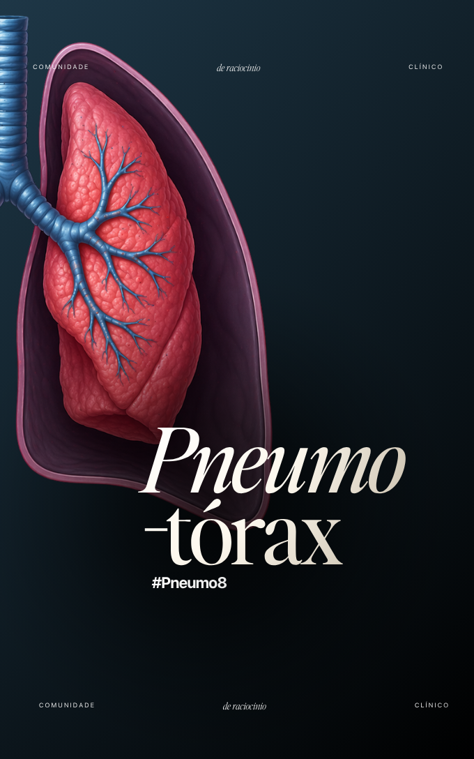 Capa de módulo da Comunidade RC