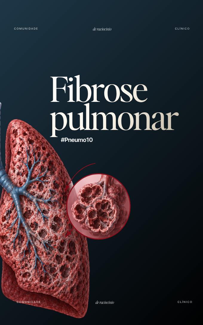 Capa de módulo da Comunidade RC