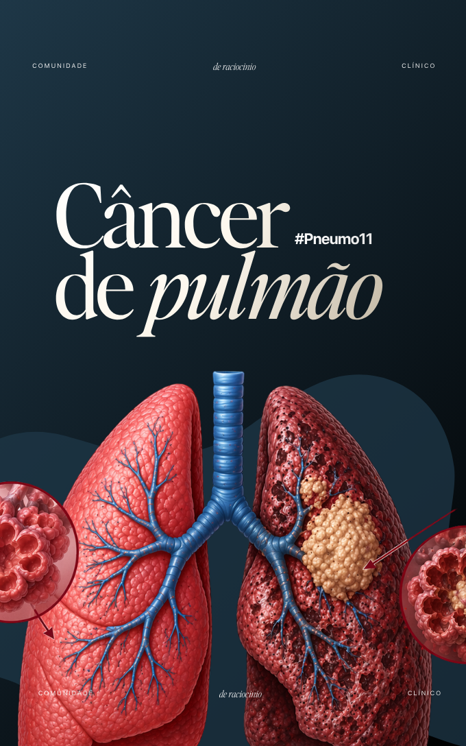 Capa de módulo da Comunidade RC